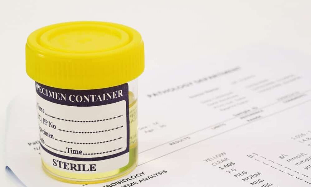 Dir musst en Urintest maachen ier Dir Antibiotike hëlt